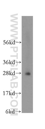 DTD1 Antibody in Western Blot (WB)