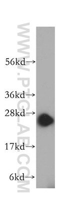 DTD1 Antibody in Western Blot (WB)