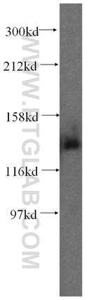 PDS5A Antibody in Western Blot (WB)