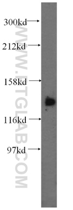PDS5A Antibody in Western Blot (WB)