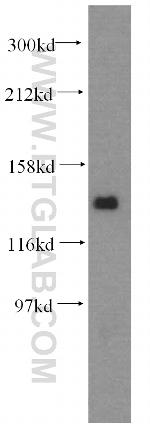 PDS5A Antibody in Western Blot (WB)