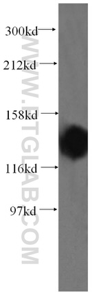 PDS5A Antibody in Western Blot (WB)