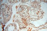 USP20 Antibody in Immunohistochemistry (Paraffin) (IHC (P))