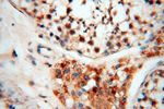 USP20 Antibody in Immunohistochemistry (Paraffin) (IHC (P))
