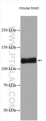 USP20 Antibody in Western Blot (WB)