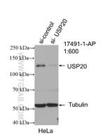 USP20 Antibody in Western Blot (WB)