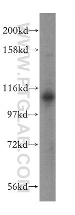 USP20 Antibody in Western Blot (WB)