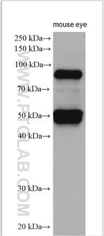 Filensin Antibody in Western Blot (WB)