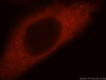 Filensin Antibody in Immunocytochemistry (ICC/IF)