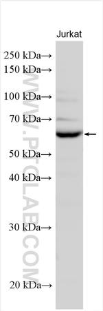 TCP11L1 Antibody in Western Blot (WB)