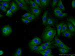 MAGEB18 Antibody in Immunocytochemistry (ICC/IF)