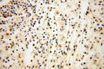 MAGEB18 Antibody in Immunohistochemistry (Paraffin) (IHC (P))