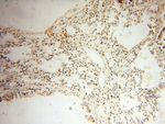 MAGEB18 Antibody in Immunohistochemistry (Paraffin) (IHC (P))