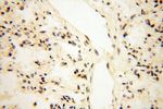 MAGEB18 Antibody in Immunohistochemistry (Paraffin) (IHC (P))
