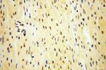 MAGEB18 Antibody in Immunohistochemistry (Paraffin) (IHC (P))