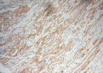 MAGEB18 Antibody in Immunohistochemistry (Paraffin) (IHC (P))