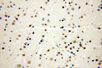 MAGEB18 Antibody in Immunohistochemistry (Paraffin) (IHC (P))