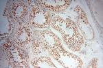 MAGEB18 Antibody in Immunohistochemistry (Paraffin) (IHC (P))