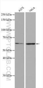 MAGEB18 Antibody in Western Blot (WB)