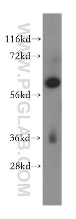 MAGEB18 Antibody in Western Blot (WB)