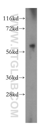 MAGEB18 Antibody in Western Blot (WB)