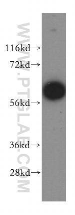 MAGEB18 Antibody in Western Blot (WB)