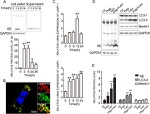 beta Amyloid Antibody in Western Blot (WB)