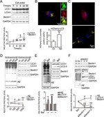 beta Amyloid Antibody in Western Blot (WB)