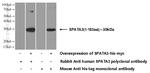 SPATA3 Antibody in Western Blot (WB)