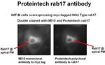 RAB17 Antibody in Immunocytochemistry (ICC/IF)