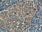RAB17 Antibody in Immunohistochemistry (Paraffin) (IHC (P))