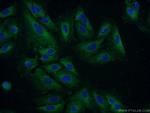 GSTCD Antibody in Immunocytochemistry (ICC/IF)