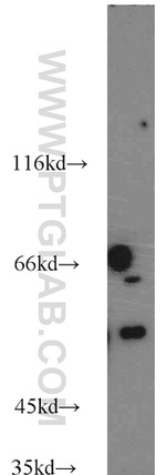 GSTCD Antibody in Western Blot (WB)