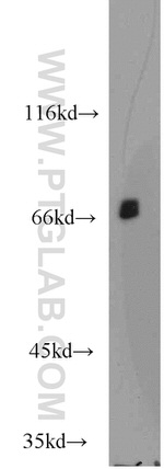 GSTCD Antibody in Western Blot (WB)