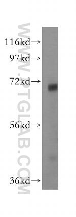 GSTCD Antibody in Western Blot (WB)