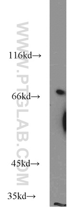 GSTCD Antibody in Western Blot (WB)