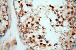 EIF4A3 Antibody in Immunohistochemistry (Paraffin) (IHC (P))