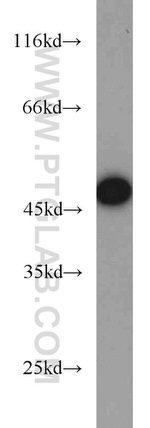 EIF4A3 Antibody in Western Blot (WB)