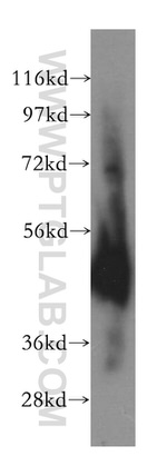 EIF4A3 Antibody in Western Blot (WB)