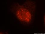 EIF4A3 Antibody in Immunocytochemistry (ICC/IF)