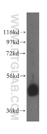 EIF4A3 Antibody in Western Blot (WB)