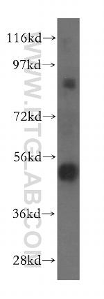 TOM1 Antibody in Western Blot (WB)