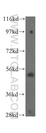 TOM1 Antibody in Western Blot (WB)