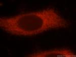 NUDT10 Antibody in Immunocytochemistry (ICC/IF)