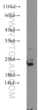 NUDT10 Antibody in Western Blot (WB)
