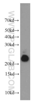NUDT10 Antibody in Western Blot (WB)