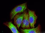 Cytokeratin 7 Antibody in Immunocytochemistry (ICC/IF)