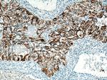 Cytokeratin 7 Antibody in Immunohistochemistry (Paraffin) (IHC (P))