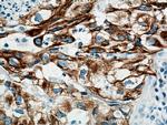Cytokeratin 7 Antibody in Immunohistochemistry (Paraffin) (IHC (P))