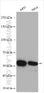 Cytokeratin 7 Antibody in Western Blot (WB)
